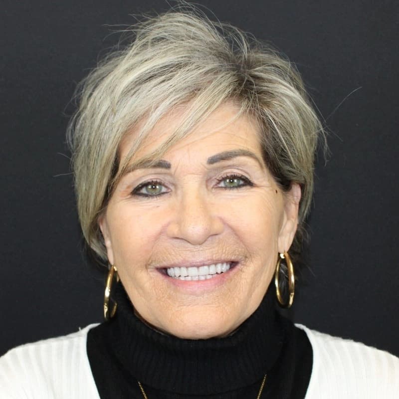 Patient after full arch dental implant restoration with a fixed Zirconia prosthetic