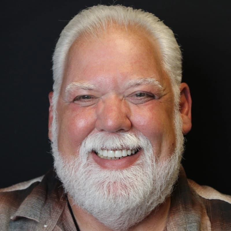 SPG patient smiling after same-day dental implant treatment