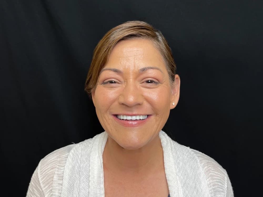 Full Arch Dental Implants